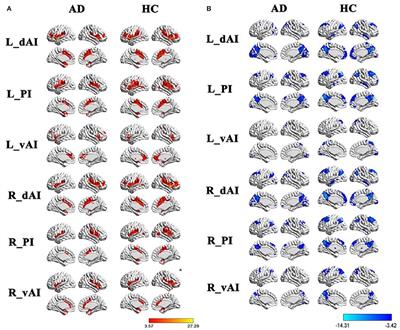 Subjective Cognitive Decline and Related Cognitive Deficits